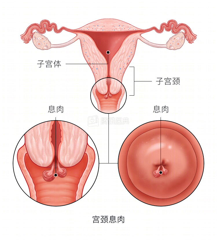 宫颈为何这么爱生病？女生最该了解的6个知识