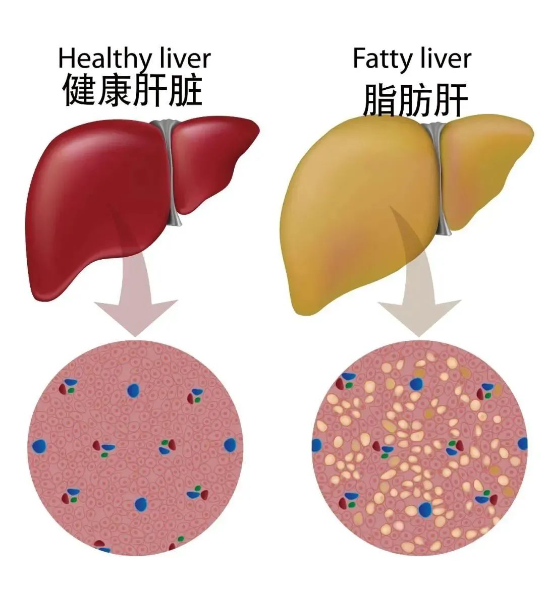 这种饮料既伤肝，又致癌！可你却每天都在喝（不是酒）