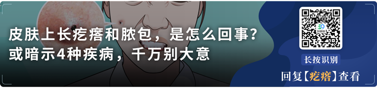 从超市买回来的肉“冒绿光”，还能吃吗？关键看4点